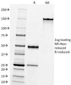 Neprilysin/CD10 Antibody (FR4D11), Novus Biologicals 0.2mg; Unlabeled:Antibodies,